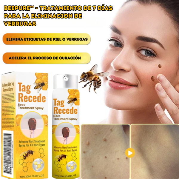 SPRAY TagRecede™ PARA VERRUGAS Y TRATAMIENTO DE LA PIEL 🎁OFERTA ESPECIAL🎁