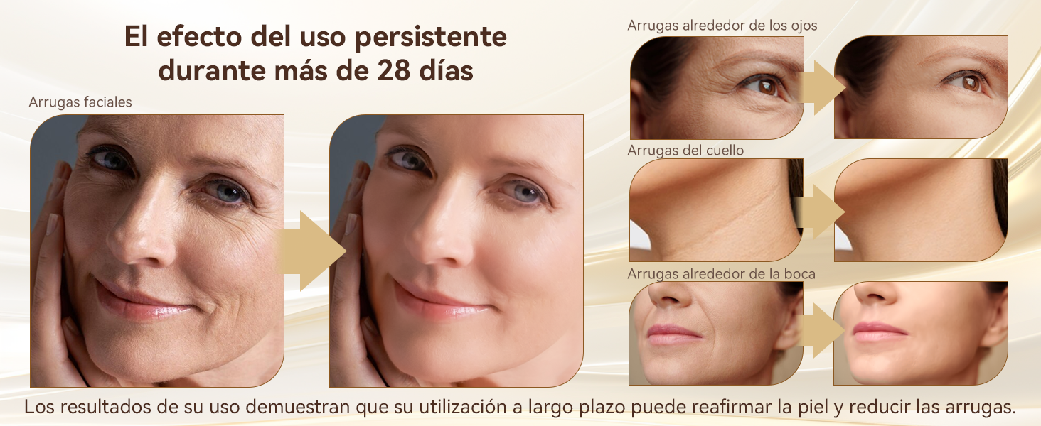 Masajeador y Rejuvenecedor total: RejuveSkin Pro