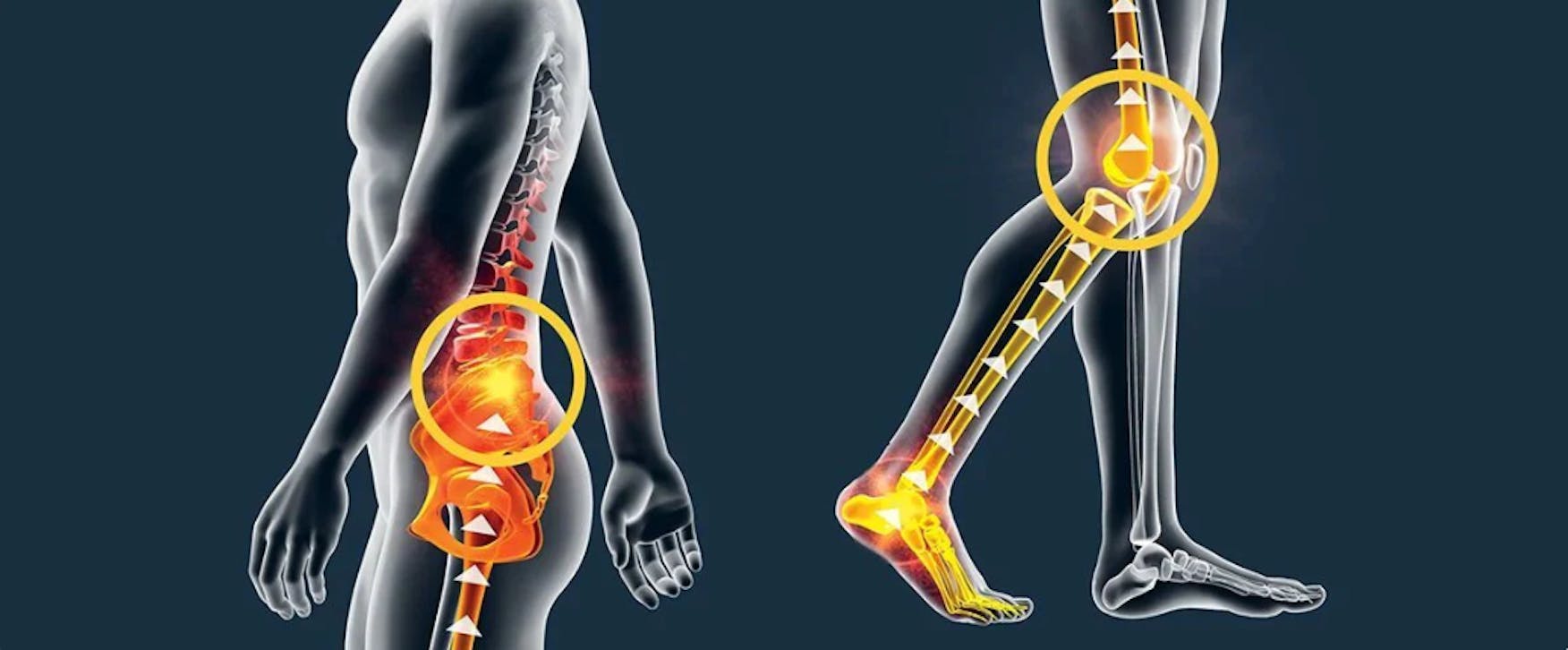 🎁PROMOCIÓN 2X1🎁 RODILLERA ESTABILIZADORA PARA EL ALIVIO DEL DOLOR DE RODILLA
