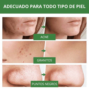 🎁PROMOCIÓN 2X1🎁 MASCARILLA DE LIMPIEZA PROFUNDA DE TÉ VERDE - GREEN MASK