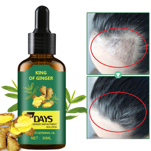 Aceite de jengibre. Crecimiento del cabello en 7 días.🎁OFERTA LIMITADA🎁