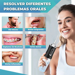🎁OFERTA ESPECIAL DEL 50%🎁 IRRIGADOR BUCAL TOOTHCLEANSO