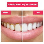 🎁OFERTA ESPECIAL DEL 50%🎁 IRRIGADOR BUCAL TOOTHCLEANSO