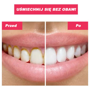 🎁OFERTA ESPECIAL DEL 50%🎁 IRRIGADOR BUCAL TOOTHCLEANSO