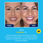 🎁 OFERTA ESPECIAL 50% 🎁 Sonrisa blanca™ – Dientes postizos para una sonrisa perfecta